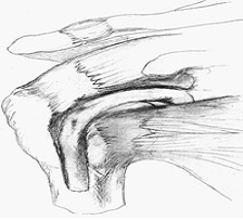 biceps tendon1